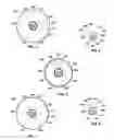 Fig. 04 - OCCLUSION PERFUSION CATHETER