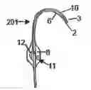 Fig. 01 - CATHETER AND SHUNT SYSTEM INCLUDING THE CATHETER