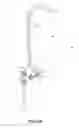 Fig. 07 - CATHETER AND SHUNT SYSTEM INCLUDING THE CATHETER