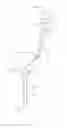 Fig. 01 - Connectable catheter