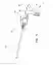 Fig. 06 - Enhanced outer sheath for extraction device