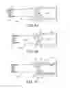 Fig. 05 - Interventional medical systems and associated methods