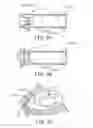 Fig. 11 - Interventional medical systems and associated methods