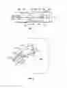 Fig. 08 - Leadless cardiac stimulation systems