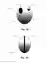 Fig. 06 - Implantable stimulation device