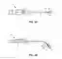 Fig. 05 - Implantable electrical stimulator with deflecting tip lead