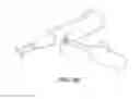 Fig. 13 - Implantable electrical stimulator with deflecting tip lead