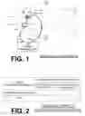 Fig. 02 - Deciding on patient electric shock therapy