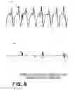 Fig. 09 - Deciding on patient electric shock therapy