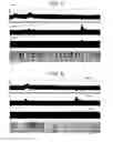 Fig. 06 - Non-invasive treatment of bronchial constriction
