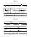 Fig. 08 - Non-invasive treatment of bronchial constriction