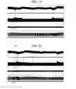Fig. 14 - Non-invasive treatment of bronchial constriction