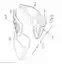 Fig. 07 - Multi-material golf club head