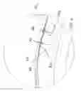 Fig. 05 - Multi-material golf club head
