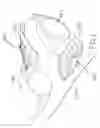 Fig. 07 - Multi-material golf club head