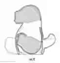 Fig. 05 - REVERSIBLE TOY