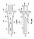 Fig. 09 - Fluid path set with turbulent mixing chamber, back flow compensator
