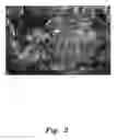 Fig. 03 - System and method for remediation of oil-contaminated sand
