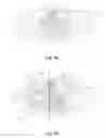 Fig. 08 - Mould for a clippable bottle