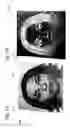 Fig. 03 - Optically variable tactile security feature