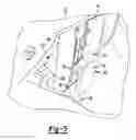 Fig. 04 - Headlamp module slip plane bracket