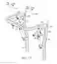 Fig. 16 - Operator protection apparatus with an over-center linkage