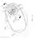 Fig. 13 - Can opener