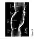 Fig. 13 - Fabrication and application of nanofiber ribbons and sheets and twisted and non-twisted nanofiber yarns