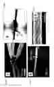 Fig. 70 - Fabrication and application of nanofiber ribbons and sheets and twisted and non-twisted nanofiber yarns
