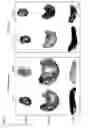 Fig. 06 - Composition for the modulation of the activity of non-structure proteins