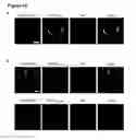 Fig. 11 - Antibody, epitope tag and method for detection, capture and/or purification of tagged polypeptides
