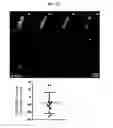 Fig. 08 - Mps1 and KNL1 phosphorylation system