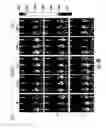 Fig. 09 - Compositions and methods for rendering tumor cells susceptible to CD8+ T cell-mediated killing