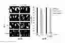 Fig. 12 - Compositions and methods for rendering tumor cells susceptible to CD8+ T cell-mediated killing