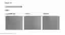 Fig. 96 - Methods of preventing inflammation and treating pain using anti-NGF compositions