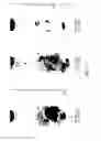 Fig. 14 - Car based immunotherapy
