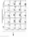 Fig. 16 - Methods of treating inflammatory diseases by administering anti-PILR-alpha antibody
