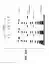 Fig. 22 - Anti-Jagged1 antibodies and methods of use