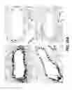 Fig. 37 - Anti-Jagged1 antibodies and methods of use