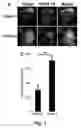 Fig. 05 - Tumor selective macropinocytosis-dependent rapidly internalizing antibodies
