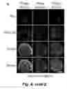 Fig. 09 - Tumor selective macropinocytosis-dependent rapidly internalizing antibodies