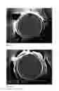 Fig. 02 - WATER EXPANDABLE POLYMER BEADS