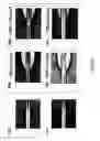 Fig. 19 - Method for detecting the presence or absence of biological particles