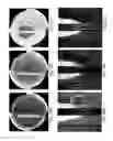 Fig. 24 - Method for detecting the presence or absence of biological particles
