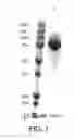 Fig. 02 - Aglycosylated enzyme and uses thereof