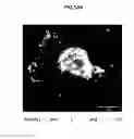 Fig. 35 - Antisense compounds targeting leucine-rich repeat kinase 2 (LRRK2) for the treatment of parkinsons disease