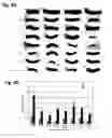 Fig. 05 - Double strand RNA-mediated RNA interference through feeding detrimental to larval (gypsy moth)