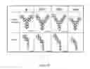 Fig. 20 - METHODS FOR MODULATING PROTEIN GLYCOSYLATION PROFILES OF RECOMBINANT PROTEIN THERAPEUTICS USING MONOSACCHARIDES AND OLIGOSACCHARIDES
