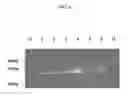 Fig. 07 - MECP2E1 GENE