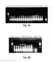 Fig. 04 - Reagents and methods for detecting HCV